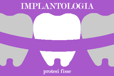 implantologia dentale